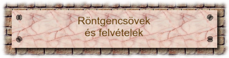 RÖNTGEN-CSÖVEK ÉS FELVÉTELEK